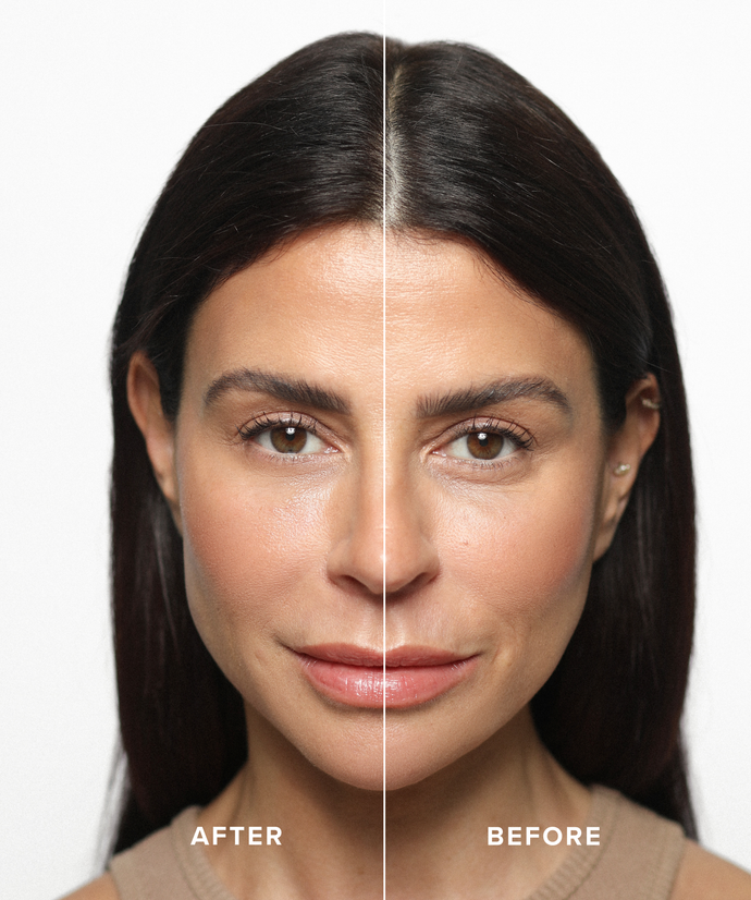 Instant Eye Lift Bundle