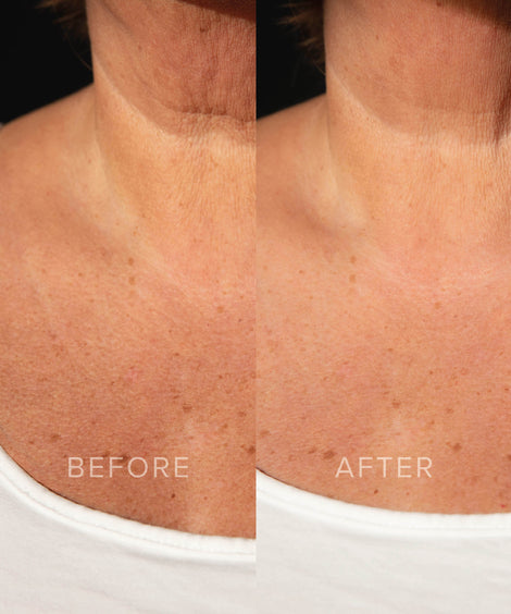 MIRACLE BODY BLUR